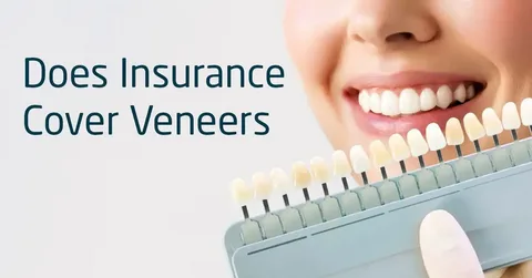 Does Dental Insurance Cover Veneers? Insights From a Cosmetic Dentist Plano
